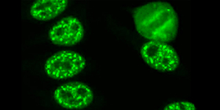 immunofluorescent staining of human cells