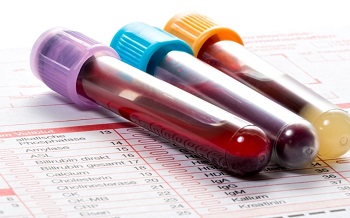 Three test vials with blood on top of a sheet of paper