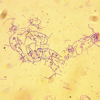 microscopic view of specimen