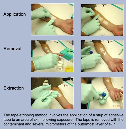 The Tape-stripping Method: Application, Removal and Extraction